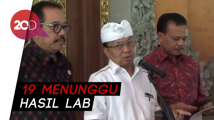 Ada 73 Pasien dalam Pengawasan di Bali, 54 Negatif