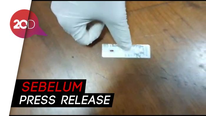 Tio Pakusadewo Rapid Test Corona, Hasilnya Negatif