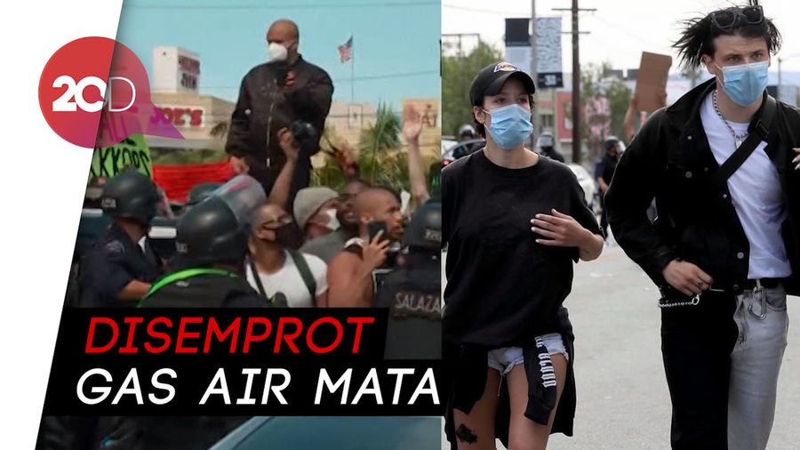 Ikut Demo soal George Floyd, Halsey Kena Peluru Karet Polisi