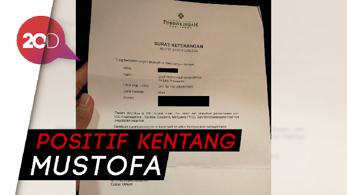 Dituding Pemakai, Hasil Tes Narkoba Bintang Emon Negatif