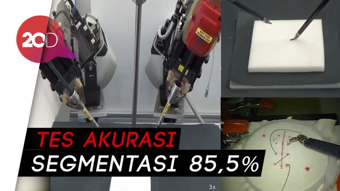 Peneliti Uji Coba Robot untuk Bantu Dokter Bedah Jahit Pasien