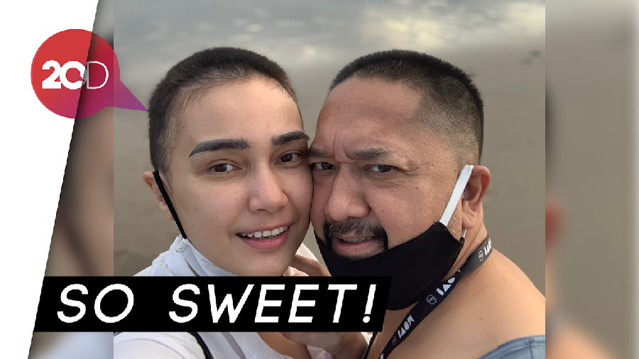 Franky Sihombing Ikutan Botak Biar Kompak dengan Feby Febiola