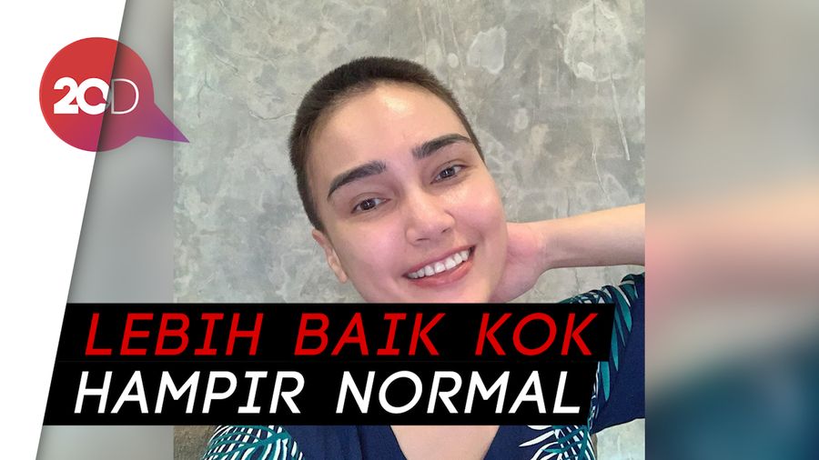 Idap Kanker Ovarium, Begini Kondisi Febi Febiola Usai Jalani Kemoterapi 