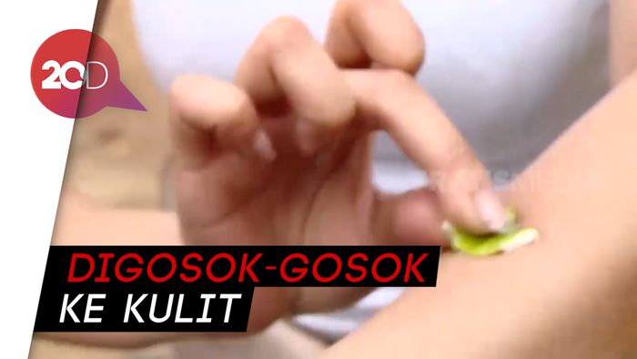 Cara Hilangkan Gatal Akibat Gigitan Nyamuk Pakai Kulit Petai