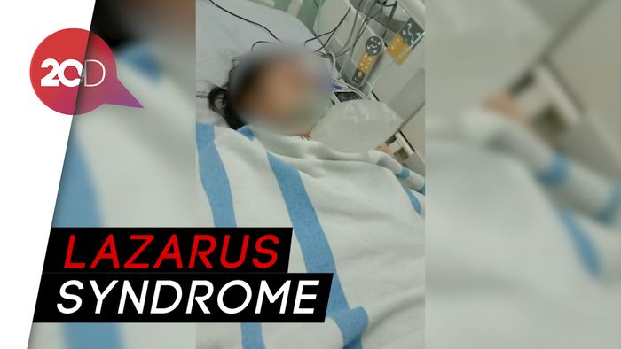 Penjelasan Dokter soal Fenomena Jenazah Hidup Lagi