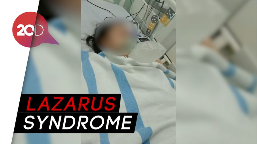 Penjelasan Dokter soal Fenomena Jenazah Hidup Lagi