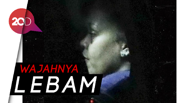 Rihanna Alami Kecelakaan Skuter Listrik