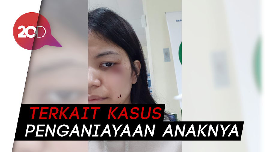 Minggu Depan Polisi Panggil Chintami Atmanegara Sebagai Saksi