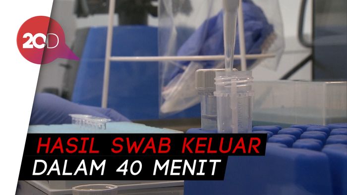 Ilmuwan Jerman Pamerkan Alat Uji Corona Baru yang Lebih Cepat