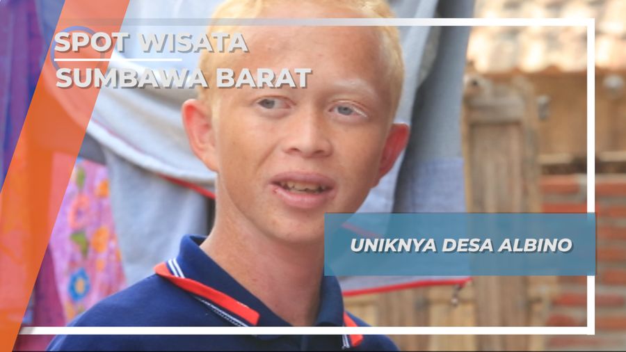 Desa Mantar Sumbawa Barat, Masyarakat dengan Warga Albino