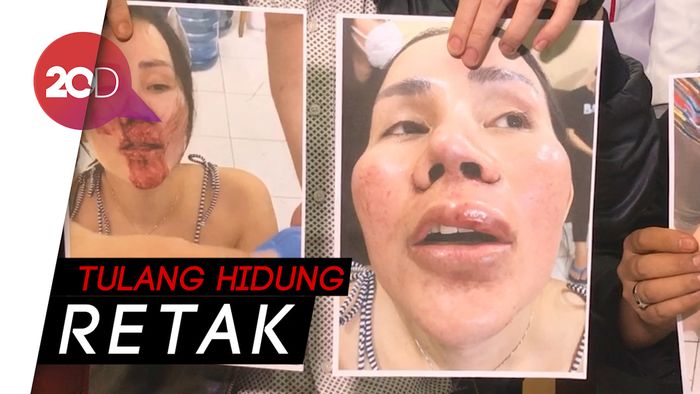 Kronologi Eks Manajer Lucinta Luna Dikeroyok Orang Tak Dikenal