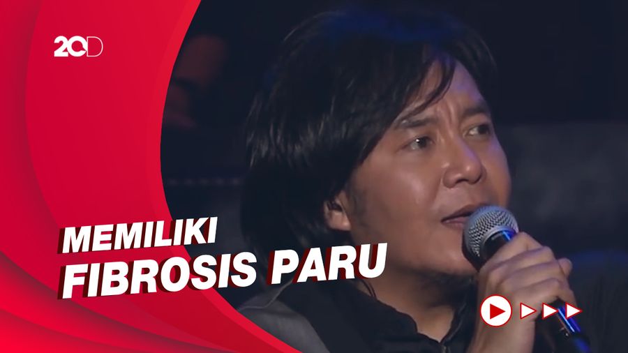 Dampak Virus Corona, Ari Lasso Alami Infeksi Paru