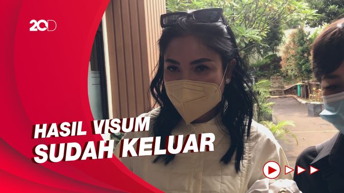 Fakta Seputar Kasus KDRT yang Dialami oleh Nindy Ayunda
