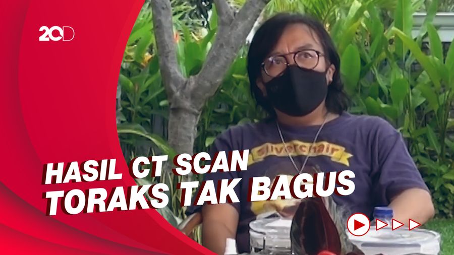 Sempat Positif Corona, Ini Gejala yang Dialami Ari Lasso