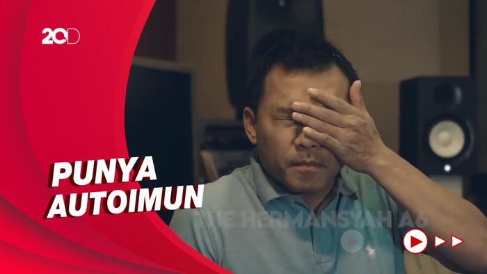 Ashanty Sempat Alami Kritis karena COVID-19