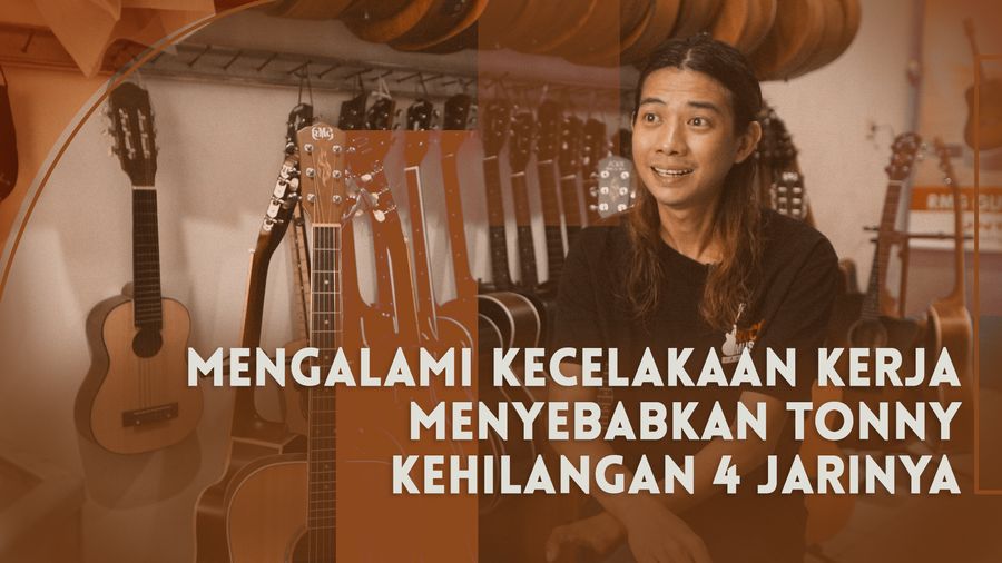 Cerita Tonny yang Harus Kehilangan 4 Jari Tangan Kirinya 