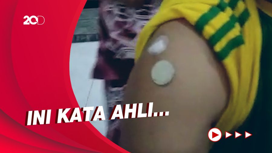 Viral Video Sebut Vaksin Corona Timbulkan Reaksi Magnetis di Tubuh