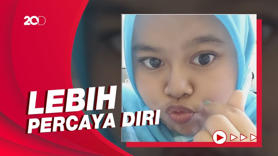 Foto Filler Hidung Kekeyi Jadi Sorotan