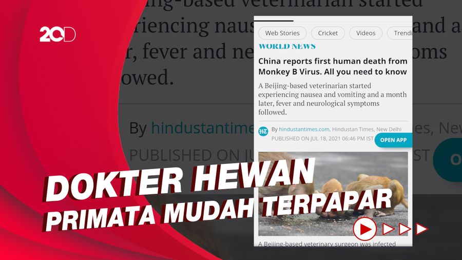 Dokter China Tewas Karena Virus Monkey B, Apa Itu?