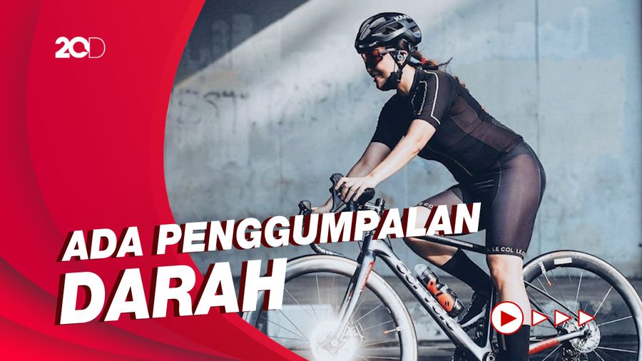 Manajer Sebut Virnie Ismail Alami Luka Cukup Serius di Wajah