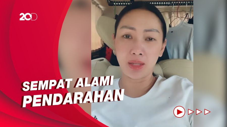 Kondisi Janin Melemah, Kalina Oktarani Minta Doa