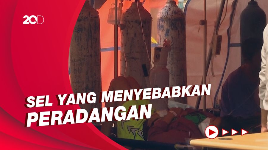 Soal Badai Sitokin Pada Pasien Covid-19