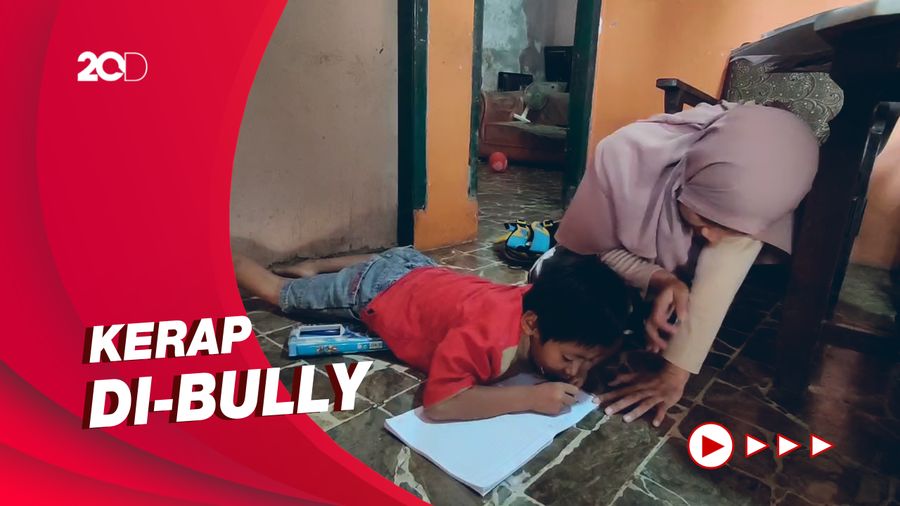 Tolong! Bocah Berkelamin Ganda di Cianjur Butuh Bantuan untuk Operasi