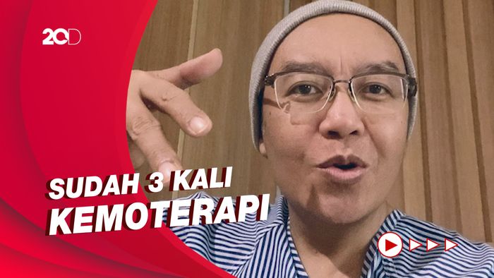Transformasi Ari Lasso dari Gondrong hingga Botak karena Kemoterapi