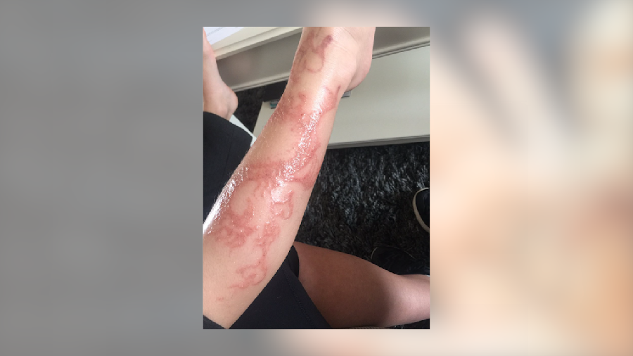 Bahaya Tato Henna pada Anak-anak