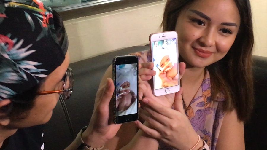 Bayi Joanna Alexandra Mengalami Kelainan Fisik