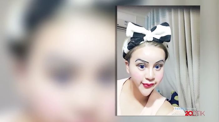 Setelah Operasi Plastik, Gadis Ini Merasa Paling Cantik Sedunia