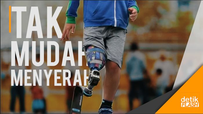 Diamputasi Sejak Kecil, Bocah Ini Bercita-cita Jadi Atlet