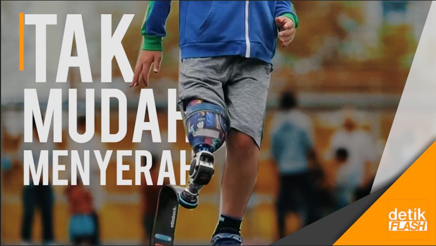 Diamputasi Sejak Kecil, Bocah Ini Bercita-cita Jadi Atlet
