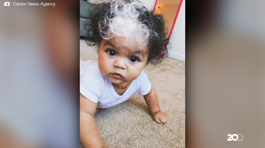 Wow, Bayi Ini Terlahir dengan Rambut Highlight Putih Alami!