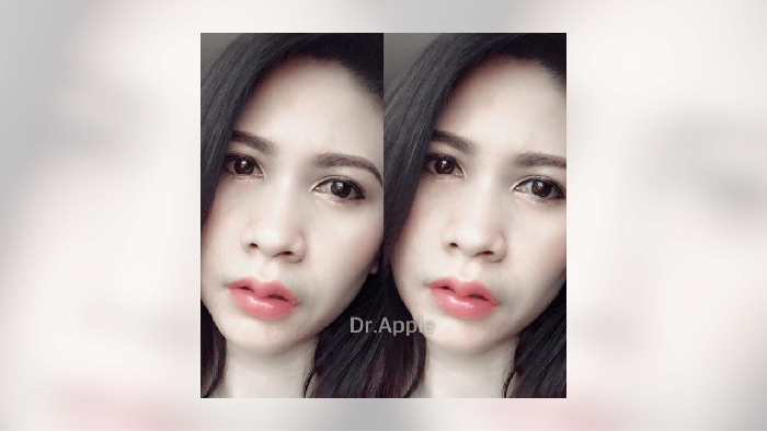 Apa Sih Tren Kecantikan Perempuan Thailand Saat Ini?