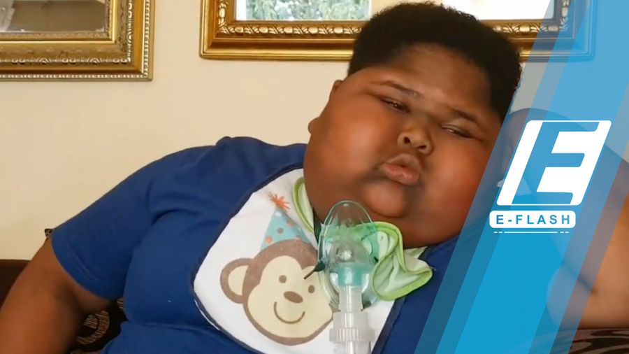 Alami Kelainan, Bocah Ini Bisa Makan Tisu hingga Kotoran