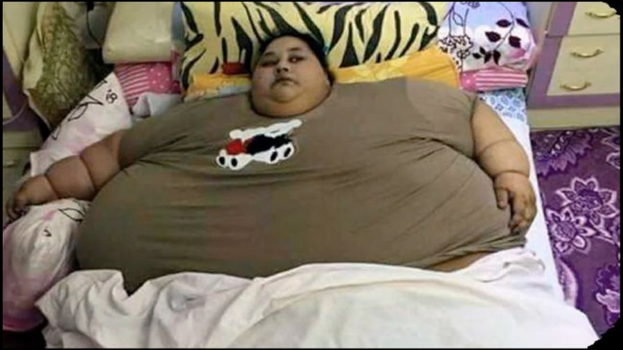 Punya Bobot 500 Kg, Perempuan Ini Sulit Bergerak
