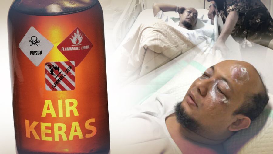 Ini yang Harus Dilakukan Bila Terpapar Air Keras