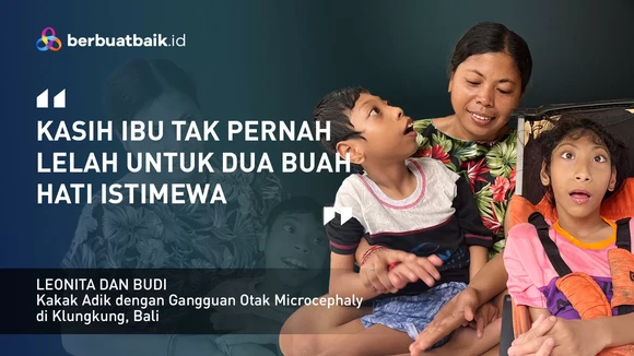 Kakak-Adik Mengalami Gangguan Otak Microcephaly, Kasih Ibu Tak Pernah Surut