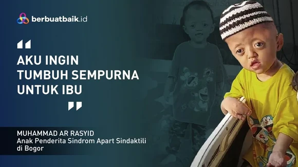 Menderita Sindrom Langka dengan Jari yang Menempel, Anak Buruh Cuci Ini Terus Semangat!