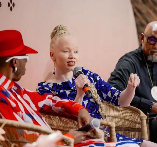 3 Tokoh Albinisme Menginspirasi Dunia