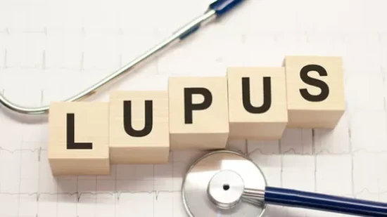 4 Fakta Penyakit Lupus: Kamu Harus Tahu