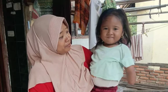 Anak Buruh Cuci dan Kuli Bongkar ini Perlu Sepatu Terapi agar Bisa Berdiri, Mari Kita Bantu