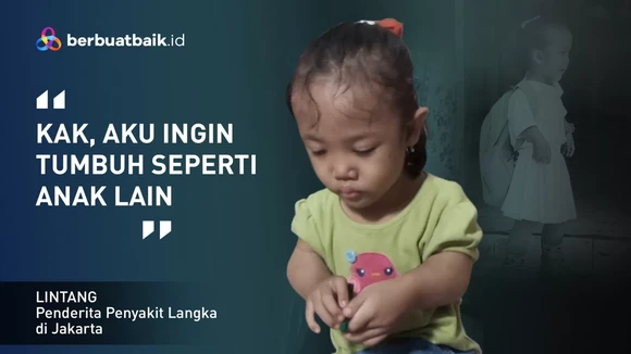 Anak Kurir Berjuang Hadapi Penyakit Langka dengan Tubuh Tak Sempurna