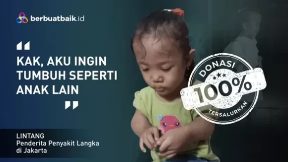 Anak Kurir Berjuang Hadapi Penyakit Langka dengan Tubuh Tak Sempurna