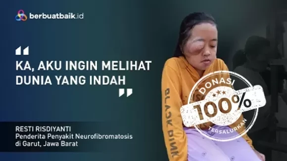 Anak Tukang Batagor Alami Tumor Punya Asa Melihat Indahnya Dunia