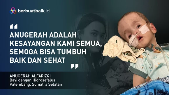 Anugerah, Bayi dengan Hidrosefalus yang Berjuang Hidup