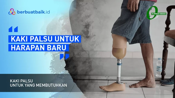 Awali Sebuah Langkah dengan Kaki Palsu