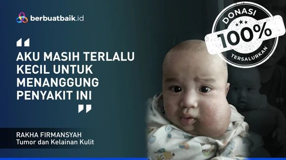Derita Balita Rakha, Pipi Membesar karena Penyumbatan Pembuluh Getah Bening