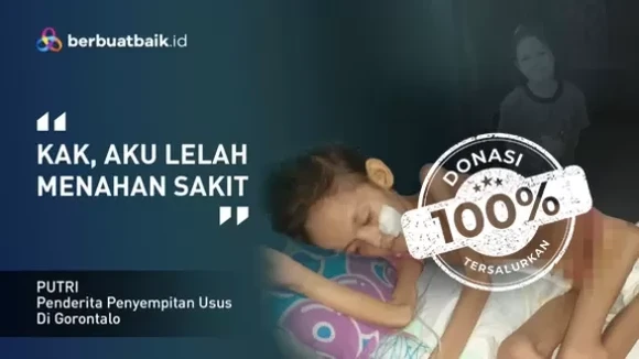 Hampir Setahun di Rumah Sakit, Putri Berjuang Sembuh dari Penyempitan Usus